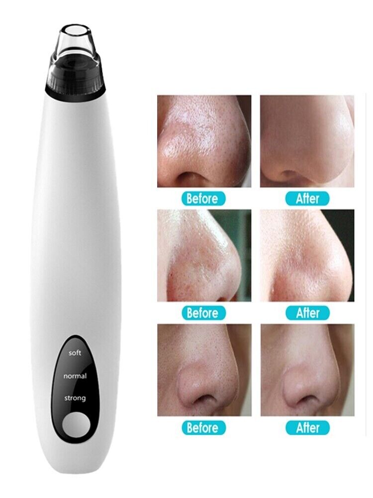 Pore Vacuum Blackhead Remover – USA Fast Shipping, 3 Speeds + 3 Heads