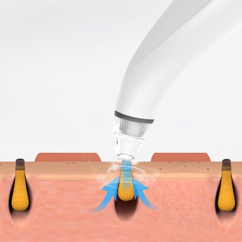 Pore Vacuum Blackhead Remover – USA Fast Shipping, 3 Speeds + 3 Heads
