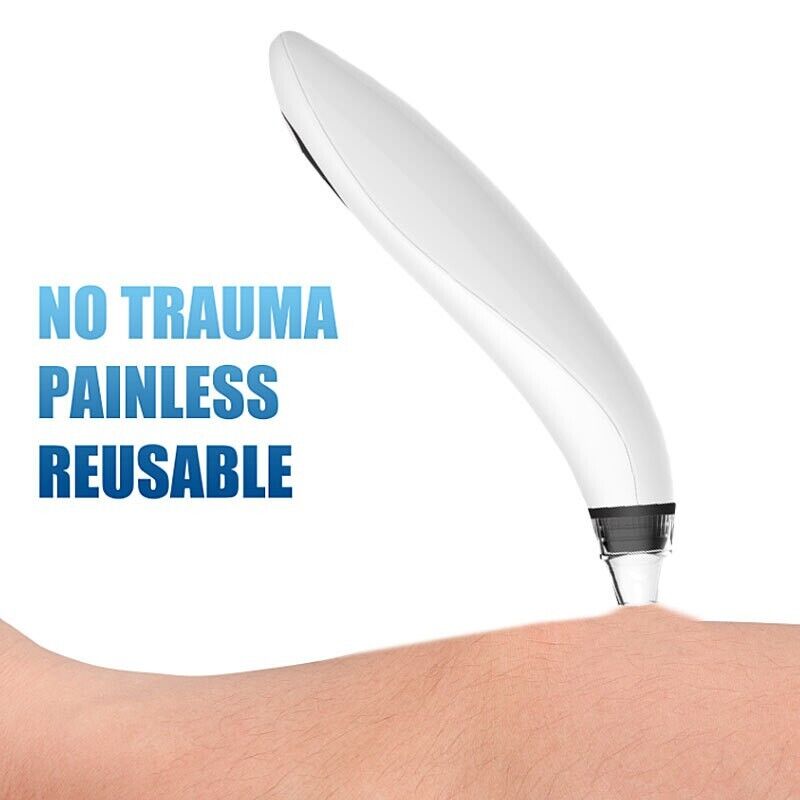 Pore Vacuum Blackhead Remover – USA Fast Shipping, 3 Speeds + 3 Heads